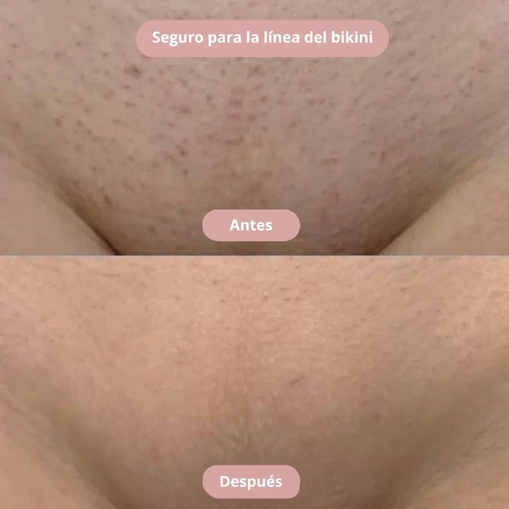 Silkyskin - Limpieza íntima sin irritación