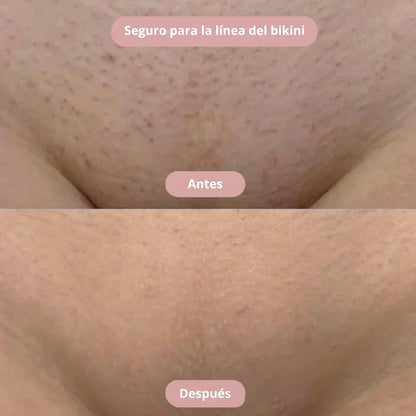Silkyskin - Limpieza íntima sin irritación